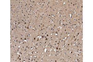 IHC analysis of Serum Response Factor/SRF using anti-Serum Response Factor/SRF antibody (ABIN7600144). (SRF anticorps  (AA 154-508))