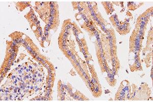 Immunohistochemistry of paraffin-embedded Human duodenum using Chromogranin A Polyclonal Antibody at dilution of 1:200 (Chromogranin A anticorps)
