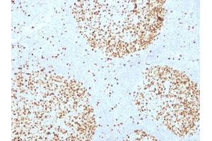 Formalin-fixed, paraffin-embedded human Tonsil stained with Topoisomerase II alpha Monoclonal Antibody (TOP2A/1361).