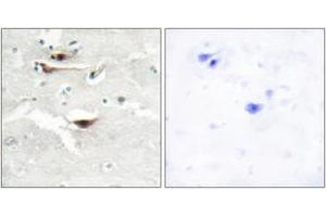Immunohistochemistry (IHC) image for anti-Inositol 1,3,4,5,6-Pentakisphosphate 2-Kinase (IPPK) (AA 11-60) antibody (ABIN2889764)
