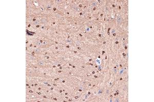 Immunohistochemistry of paraffin-embedded mouse brain using Carbonic Anhydrase 2 (C) Rabbit mAb (ABIN7266070) at dilution of 1:100 (40x lens). (CA2 anticorps)