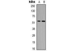 Western blot analysis of Alpha-tubulin (AcK352) expression in A549 (A), Jurkat (B) whole cell lysates. (alpha Tubulin anticorps  (acLys352))