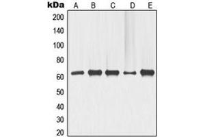 Western blot analysis of p63 expression in COLO205 (A), ME180 (B), HeLa (C), LOVO (D), HT29 (E) whole cell lysates. (TCP1 alpha/CCTA anticorps  (N-Term))