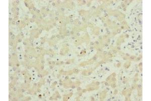 Immunohistochemistry of paraffin-embedded human liver tissue using ABIN7173949 at dilution of 1:100