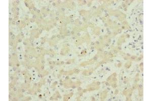 Immunohistochemistry of paraffin-embedded human liver tissue using ABIN7173949 at dilution of 1:100 (TWIST2 anticorps  (AA 1-70))