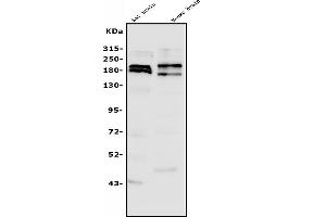 Western blot analysis of SHANK3 using anti-SHANK3 antibody (ABIN7600006).