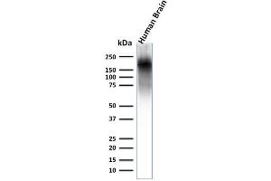 Western Blot Analysis of human brain lysate using Neurofilament Rabbit Recombinant Monoclonal Ab (NEFL.
