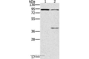 Western blot analysis of Mouse kidney and brain tissue, using CNGA3 Polyclonal Antibody at dilution of 1:500 (CNGA3 anticorps)
