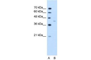 WB Suggested Anti-GNAS  Antibody Titration: 2. (GNAS anticorps  (C-Term))