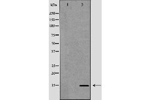 Western blot analysis of mouse heart using KCNE1 antibody.