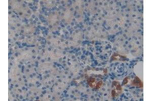Used in DAB staining on fromalin fixed paraffin- embedded kidney tissue (CSTA anticorps  (AA 1-103))