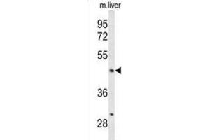 Western Blotting (WB) image for anti-Angiopoietin-Like 4 (ANGPTL4) antibody (ABIN3004083) (ANGPTL4 anticorps)