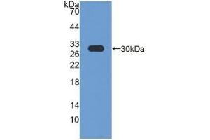 Detection of Recombinant HMGCR, Rat using Polyclonal Antibody to 3-Hydroxy-3-Methylglutaryl Coenzyme A Reductase (HMGCR) (HMGCR anticorps  (AA 638-887))