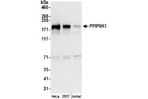 Western Blotting (WB) image for anti-diphosphoinositol Pentakisphosphate Kinase 1 (PPIP5K1) (AA 1383-1433) antibody (ABIN7450592)