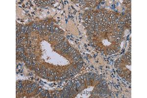 Immunohistochemistry of Human brain  using IFRD1 Polyclonal Antibody at dilution of 1:30 (IFRD1 anticorps)