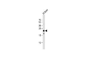 Anti-AB Antibody (Center)at 1:1000 dilution + human liver lysates Lysates/proteins at 20 μg per lane. (MMAB anticorps  (AA 50-81))