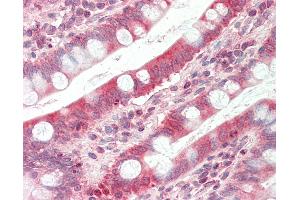 Anti-TAPBP / Tapasin antibody IHC staining of human small intestine.