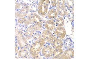 Immunohistochemistry of paraffin-embedded rat kidney using PNLIP antibody at dilution of 1:200 (400x lens). (PNLIP anticorps)