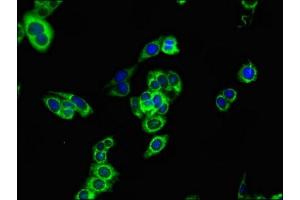 anti-Carnitine Palmitoyltransferase 1B (Muscle) (CPT1B) (AA 165-318) antibody