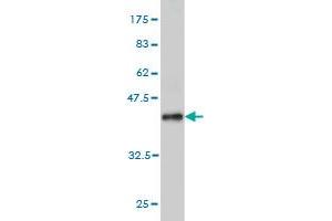 Western Blot detection against Immunogen (37. (SKP1 anticorps  (AA 53-160))