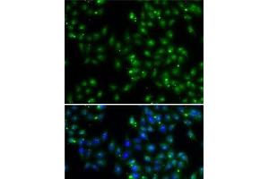 Immunofluorescence analysis of A-549 cells using DUSP22 Polyclonal Antibody (DUSP22 anticorps)