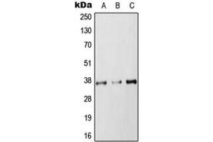 Western blot analysis of RAB36 expression in HEK293T (A), NIH3T3 (B), PC12 (C) whole cell lysates. (RAB36 anticorps  (Center))