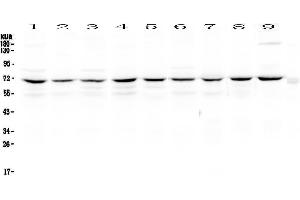 Western blot analysis of cIAP1 using anti-cIAP1 antibody .