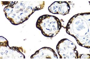 Immunohistochemistry of paraffin-embedded Human placenta using FGFR2 Polyclonal Antibody at dilution of 1:100 (40x lens). (FGFR2 anticorps)