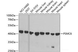 Western blot analysis of extracts of various cell lines using PSMC6 Polyclonal Antibody at dilution of 1:1000. (PSMC6 anticorps)