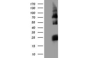 Western Blotting (WB) image for anti-Histidyl-tRNA Synthetase 2, Mitochondrial (Putative) (HARS2) antibody (ABIN1498585) (HARS2 anticorps)