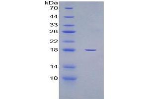 SDS-PAGE of Protein Standard from the Kit (Highly purified E. (GAPDH Kit CLIA)