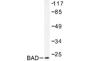 Image no. 1 for anti-BCL2-Associated Agonist of Cell Death (BAD) antibody (ABIN271900) (BAD anticorps)