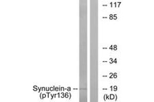 Western blot analysis of extracts from mouse brain, using Synuclein-alpha (Phospho-Tyr136) Antibody. (SNCA anticorps  (pTyr136))