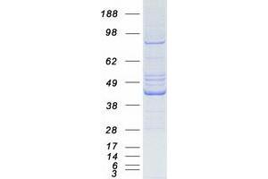 Validation with Western Blot