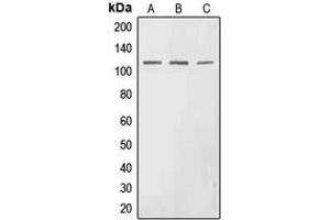 Western blot analysis of EPHA3 (pY602) expression in HEK293T (A), SP2/0 (B), H9C2 (C) whole cell lysates. (EPH Receptor A3 anticorps  (pTyr602))
