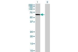 Lane 1: APPBP2 transfected lysate ( 64.