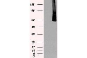 Image no. 6 for anti-Polo-Like Kinase 1 (PLK1) antibody (ABIN1500283)
