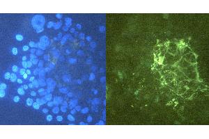 Immunocytochemistry staining of tenascin C in U-87 MG cells using purified mouse monoclonal antibody T2H7 (concentration in sample 12 μg/mL, GAM FITC, right picture) vs.