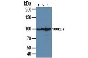 Western blot analysis of (1) Human 293T Cells, (2) Human PC-3 Cells and (3) Human MCF-7 Cells. (CD276 anticorps  (AA 47-219))