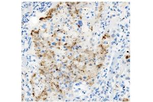 IHC analysis of ATG4A using anti-ATG4A antibody (ABIN7603108). (ATG4A anticorps  (N-Term))