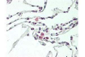 Human Lung: Formalin-Fixed, Paraffin-Embedded (FFPE)