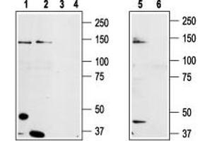 Western blot analysis of prostate carcinoma cell lines DU145 (lanes 1 and 3), Human LNCaP prostate carcinoma (lanes 2 and 4) and mouse-TRPM8 transfected HEK-293 (lanes 5 and 6) cell lysates: - 1,2,5. (TRPM8 anticorps  (3rd Extracellular Loop))