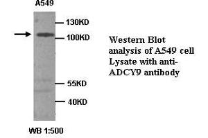Image no. 1 for anti-Adenylate Cyclase 9 (ADCY9) antibody (ABIN1574484) (ADCY9 anticorps)