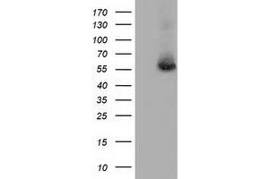Image no. 2 for anti-thromboxane A Synthase 1 (Platelet) (TBXAS1) antibody (ABIN1501383)