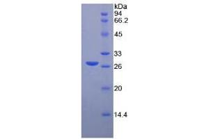 SDS-PAGE of Protein Standard from the Kit  (Highly purified E. (MMP2 Kit ELISA)