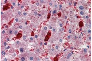 Human Liver: Formalin-Fixed, Paraffin-Embedded (FFPE) (Cell Adhesion Molecule 4 anticorps  (AA 370-384))