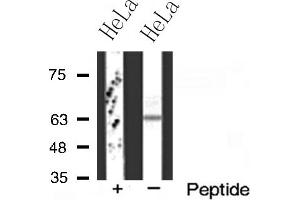 Western blot analysis of FZD2 expression in HeLa cells (FZD2 anticorps  (Internal Region))