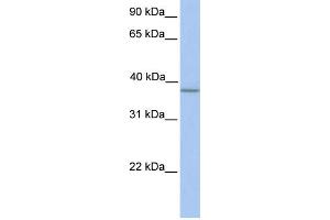 WB Suggested Anti-A4GNT Antibody Titration:  0. (A4GNT anticorps  (N-Term))