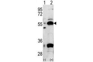 Image no. 1 for anti-Pyruvate Dehydrogenase Complex, Component X (PDHX) (C-Term) antibody (ABIN357414) (PDHX anticorps  (C-Term))