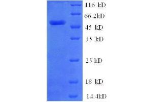 Zinc Finger Protein 592 (ZNF592) (AA 1-242), (partial) protein (GST tag)